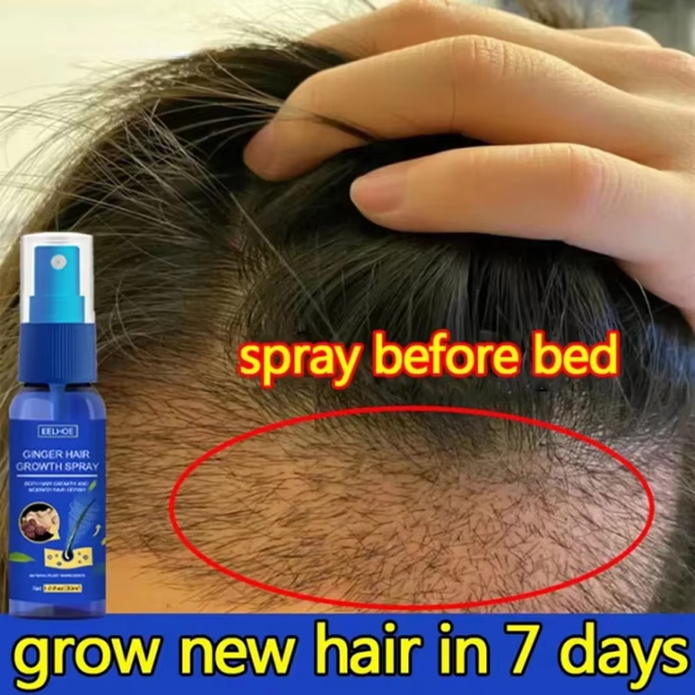 Hair Care Nutrition - 빠른 생강 모발 성장 스프레이, 모발