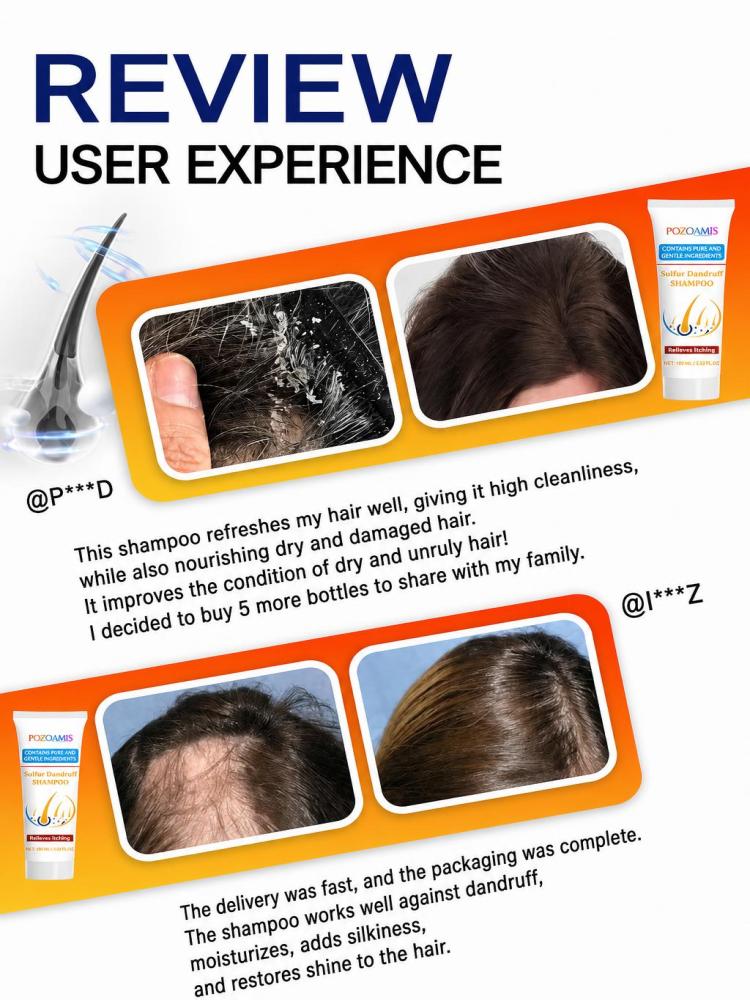 일상용 유황 헤어 클렌징 샴푸, 눈에 띄는 비듬을 줄여 - Hair Care Daily Routine 리뷰 및 가격