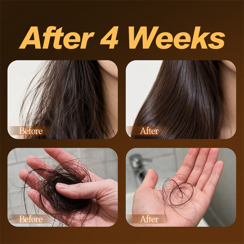 수제 블랙솝 120g 천연 허브 고체 헤어 비누 탈모  - Hair Care Herbal 리뷰 및 가격
