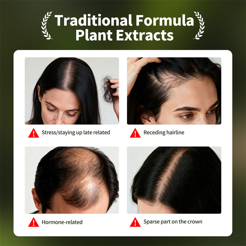 자연 모발 성장 세트 우스만 허브 샴푸 비누 허브 모발 - Hair Care Herbal 리뷰 및 가격