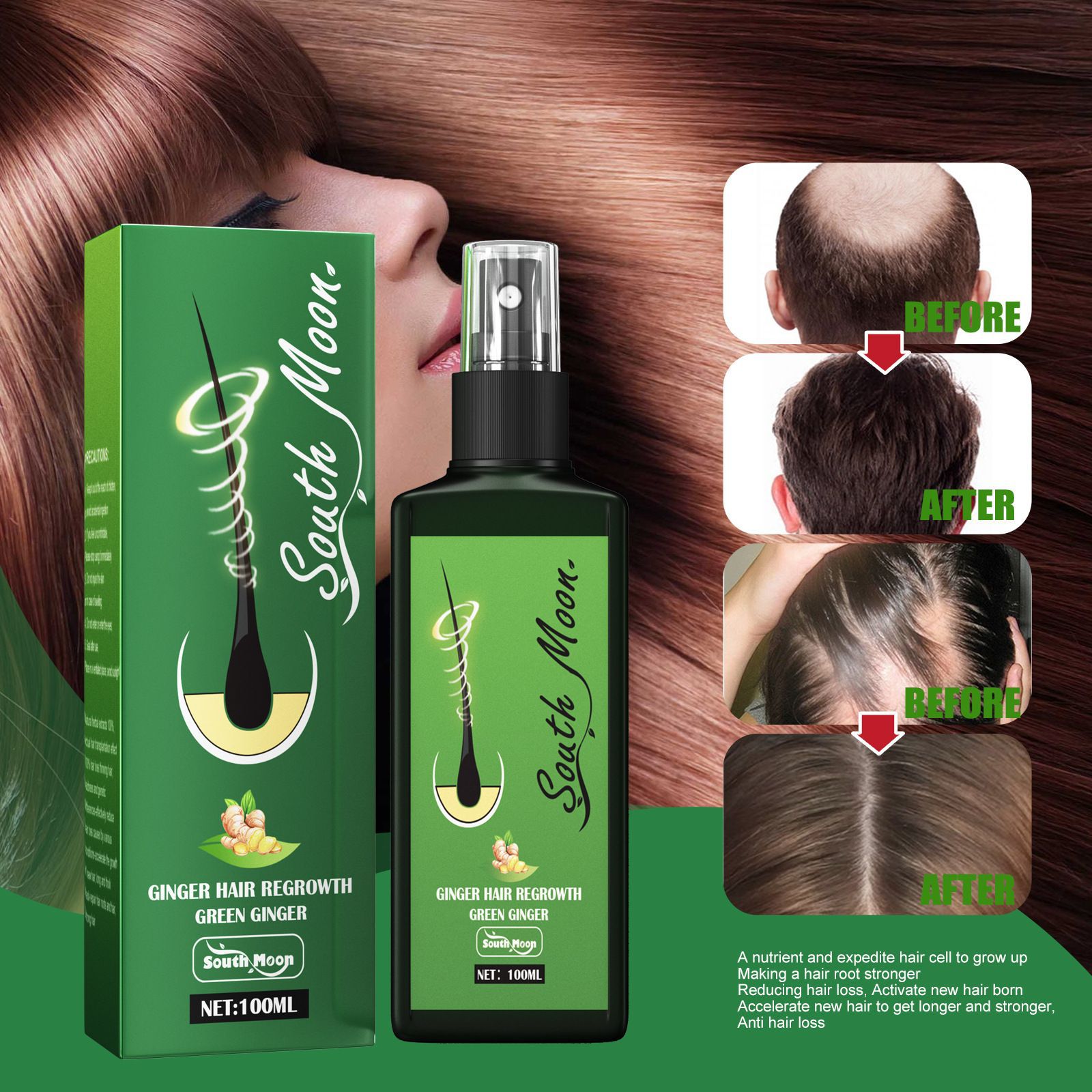 사우스 문 진저 헤어 그로우 스프레이 모근 강화 및 모 - Hair Care Herbal 리뷰 및 가격
