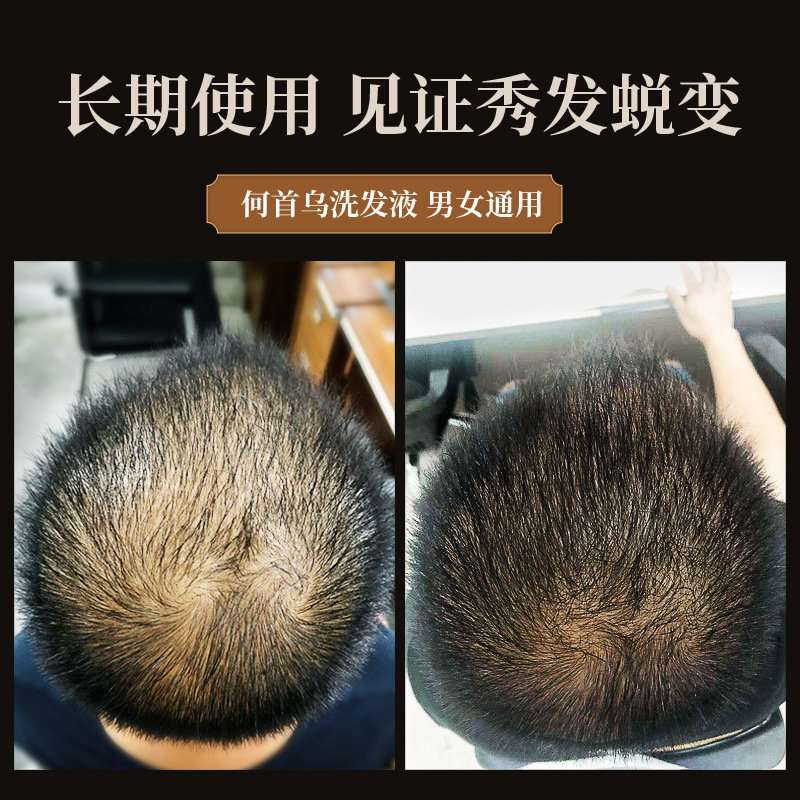 300ml 다각형 멀티 플로럼 샴푸 허브 블랙 샴푸,  - Hair Care Herbal 리뷰 및 가격