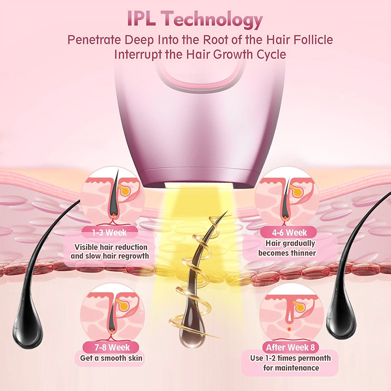IPL 레이저 제모기 헤어 커팅 머신 스트레이트 너 진 - Hair Care Or Haircare 리뷰 및 가격