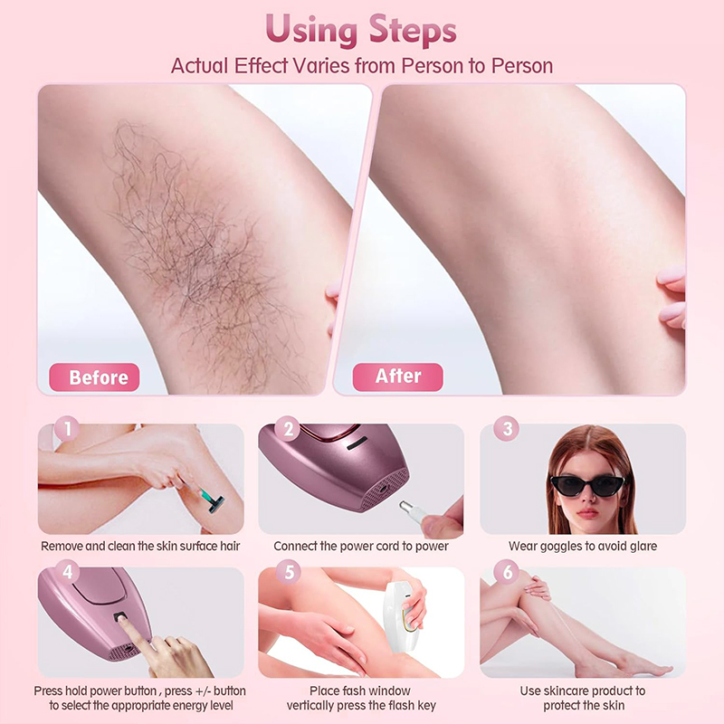 IPL 레이저 제모기 헤어 커팅 머신 스트레이트 너 진 - Hair Care Or Haircare 리뷰 및 가격
