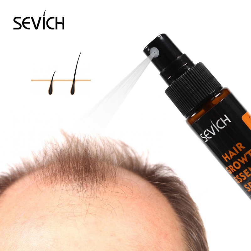 Sevich 헤벌 오일 에센스, 빠른 모발 성장 스프레 - Hair Care Herbal 리뷰 및 가격