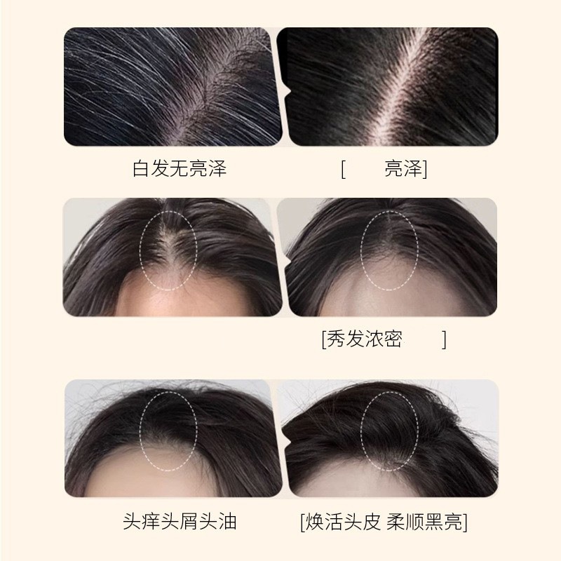 포티 진저 세이지 샴푸 모발 성장 촉진, 탈모 방지,  - Hair Care Herbal 리뷰 및 가격
