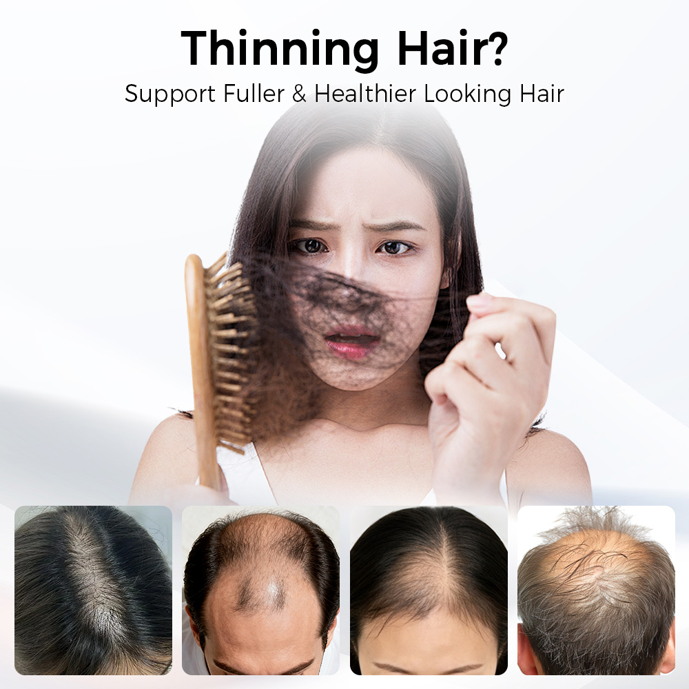 LED 헤어 성장 캡 레드 블루 라이트 테라피 모자 6 - Hair Care Nutrition 리뷰 및 가격